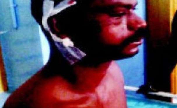 കാട്ടാനയുടെ ആക്രമണത്തില് പരിക്കേറ്റ യുവാവ് മരിച്ചു