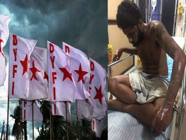 ഡിവൈഎഫ്‌ഐ നേതാവിനെതിരെ ആസിഡ് ആക്രമണം, ഗുരുതര പരിക്ക്