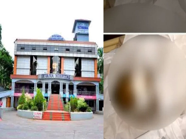 മോര്‍ച്ചറിയില്‍ സൂക്ഷിച്ച മൃതദേഹം എലി കരണ്ടു; സ്വകാര്യ ആശുപത്രിക്കെതിരെ പരാതി