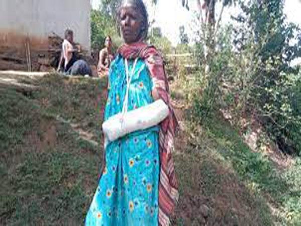അട്ടപ്പാടി കാട്ടുപന്നിയുടെ ആക്രമണത്തിൽ ആദിവാസി സ്ത്രീക്ക് പരുക്ക്