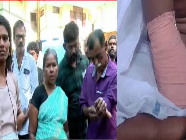 വലത് കൈ മുറിച്ചു മാറ്റേണ്ടി വന്ന കുട്ടിക്ക് ഇന്ന് ശസ്ത്രക്രിയ